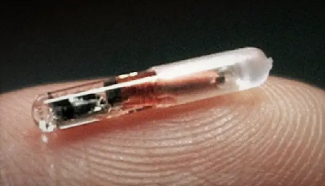 U.S. Company Implanting Microchips In Employees